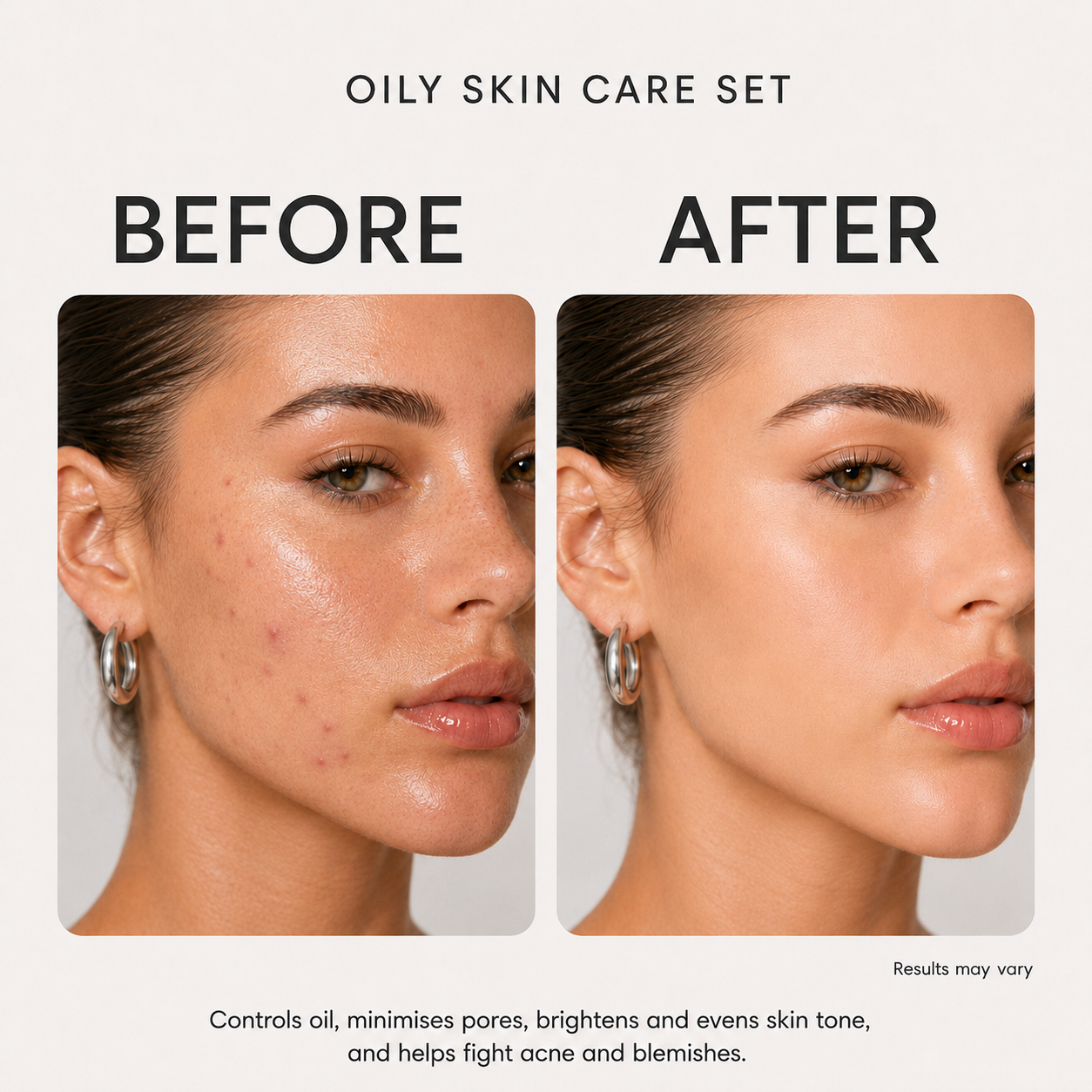 Oily Skin Care Set