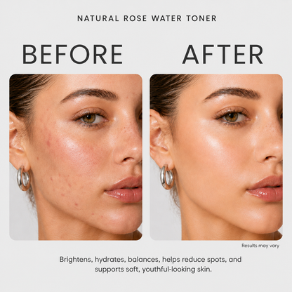 Natural Rose Water Toner - 130ml